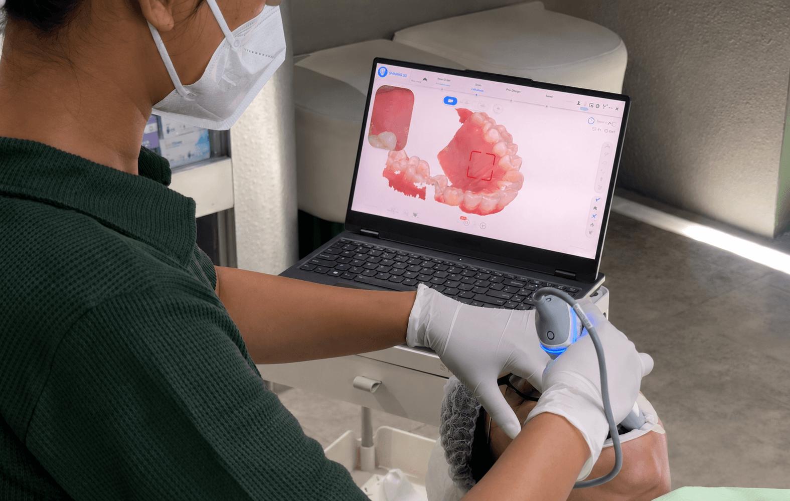 Digital scanning makes smile planning more precise